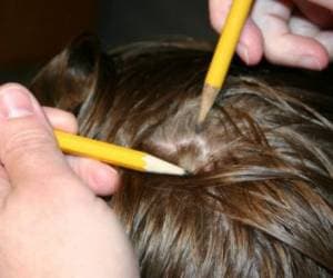 جهت مشاهده روش های پیشگیری و مبارزه با آلودگی شپش سر کلیک کنید.